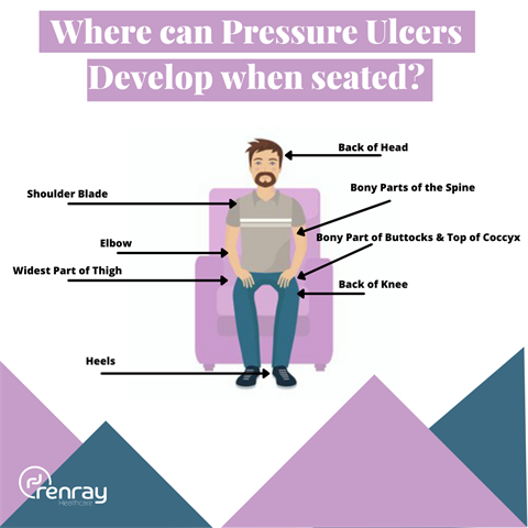 where can pressure ulcers develop when seated